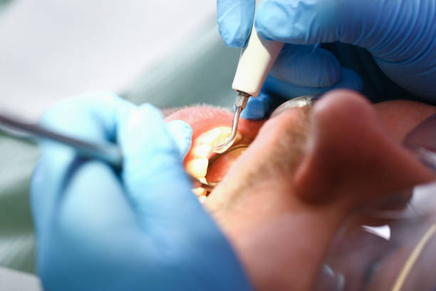 Best Pediatric Emergency Dentist in Lauderdale, MN